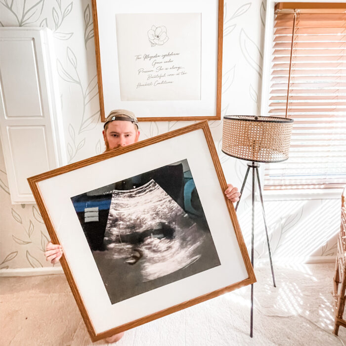 The Perfect Baby Picture Frames: a framed ultrasound image of a baby